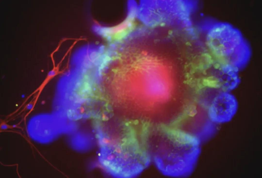 开云-《自然》重磅！刚刚，终于发现酒精伤肝底层逻辑了，你还敢喝吗？